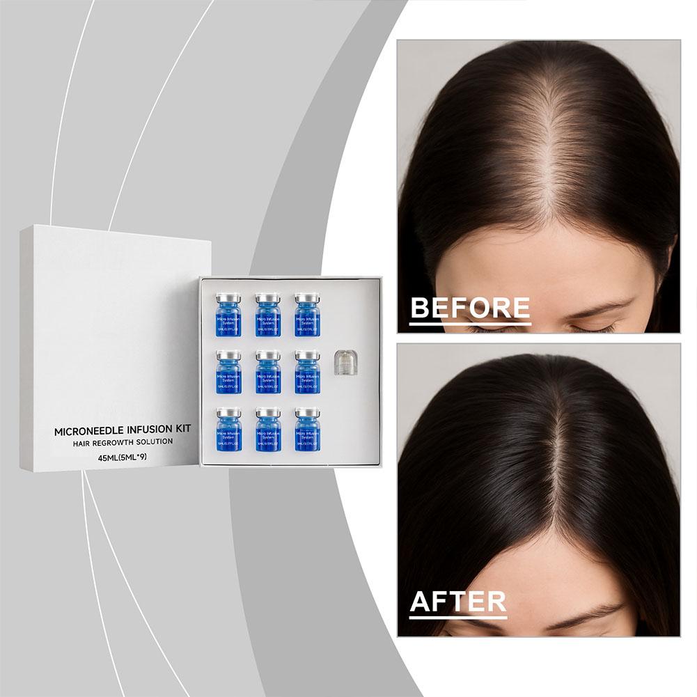 Derma Roller 0.25 - 0.25mm Haar Essentiële Serum Micro-naald Roller