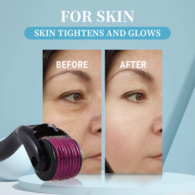 Professionele 540 Roller Derma - Derma Roller 0.25 recensie en prijs